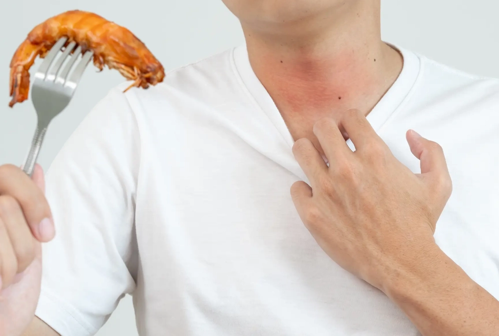 restaurant allergy protocol